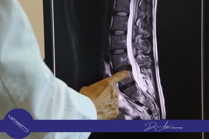 آمادگی‌های لازم قبل از جراحی دیسک کمر
