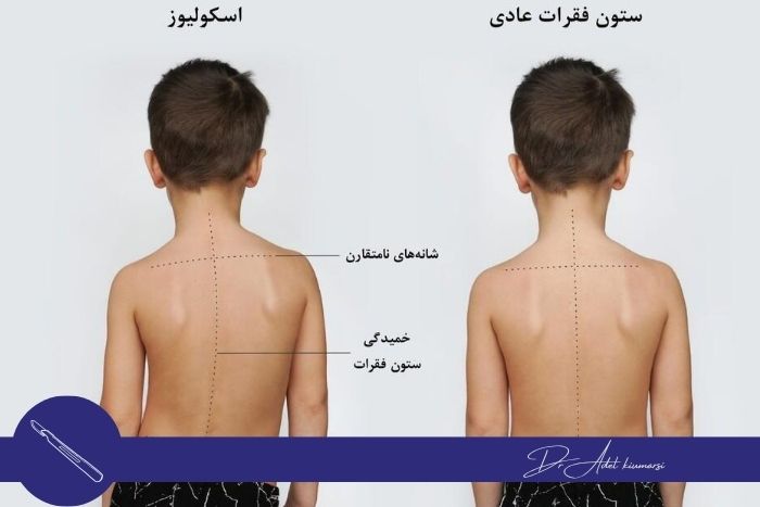 انحرافات چگونه تشخیص داده می شود؟