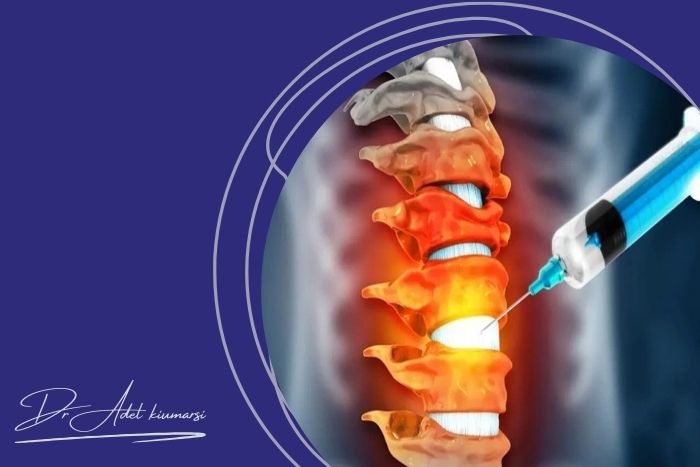 آیا تزریق کودال بی ‌خطر است؟ بیماران باید چه نکاتی را رعایت کنند؟