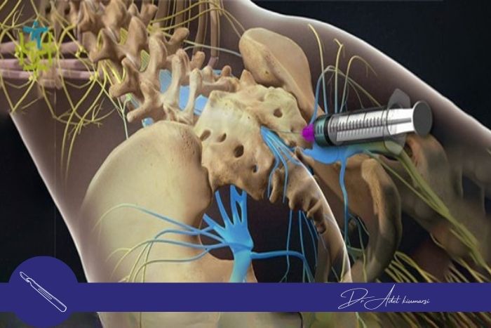 آیا تزریق کودال بی ‌خطر است؟