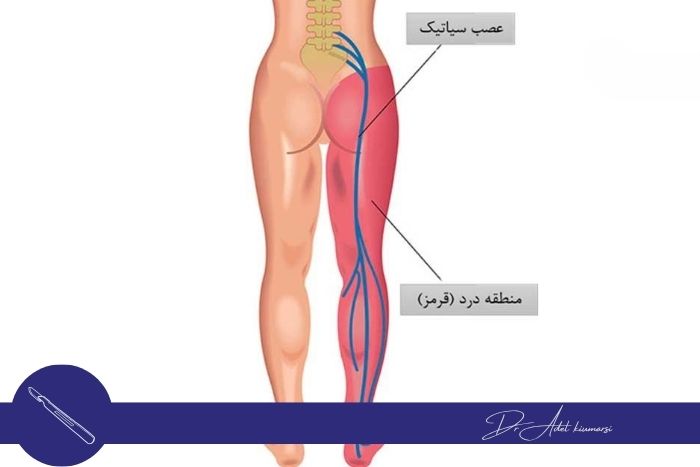 علائم و نشانه‌های بالینی درد عصبی