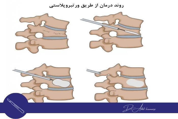 انواع روش های جراحی