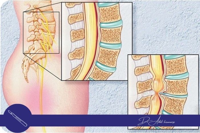 این روش برای چه کسانی مناسب است؟