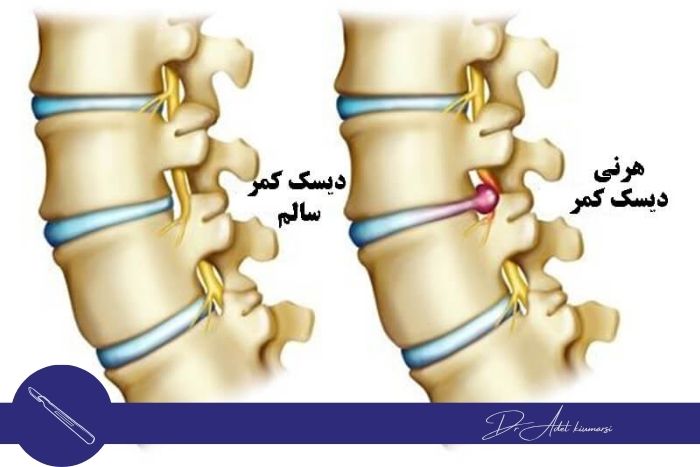 پیش‌نیازها و توصیه‌های قبل از جراحی