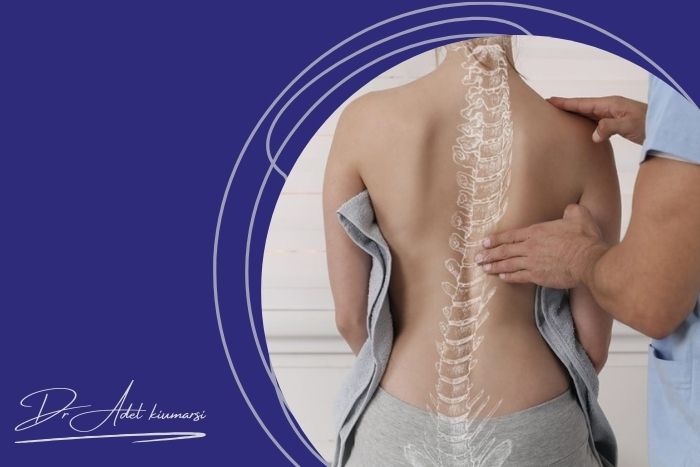مراقبت‌های بعد از جراحی انحراف ستون فقرات و بازگشت به زندگی عادی