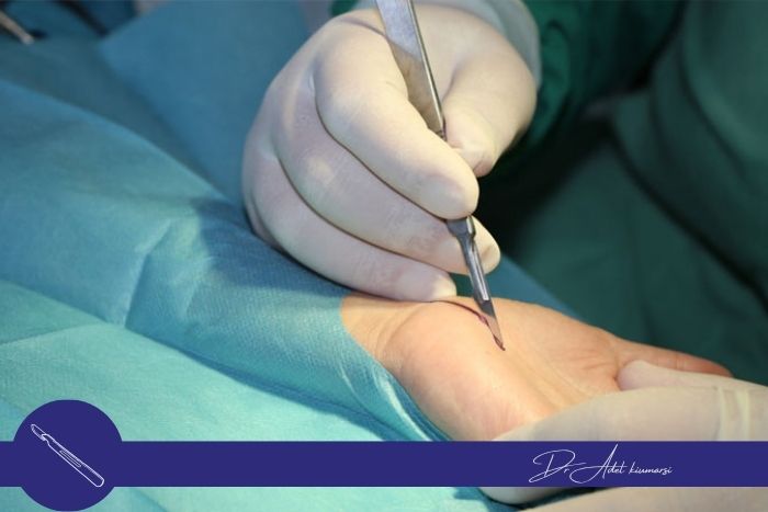 روش‌های درمان قطع عصب دست 