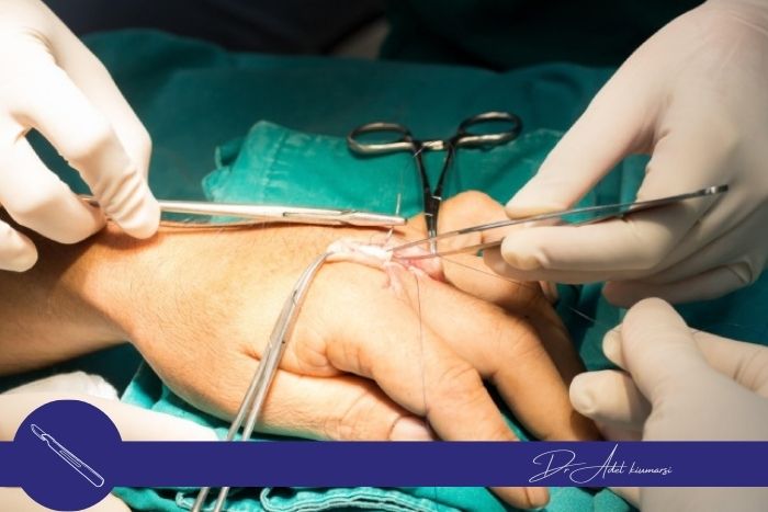 روش‌های درمانی و تأثیر آن‌ها بر زمان بهبودی