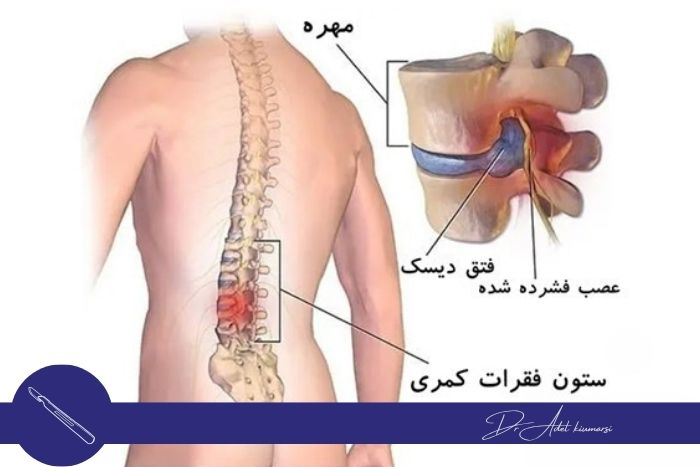 عوامل مؤثر در تصمیم‌گیری برای جراحی