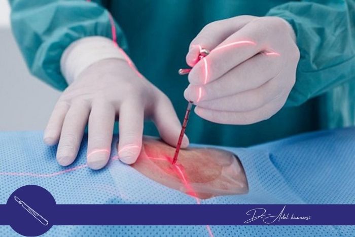 لیزر درمانی چیست و چگونه عمل می‌کند؟