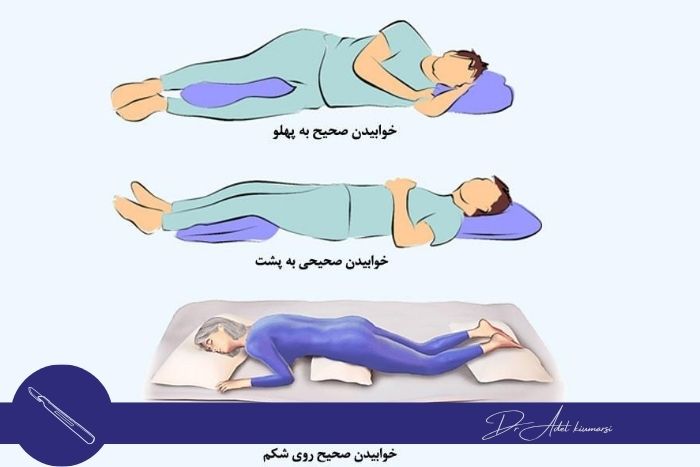 مراقبت های بعد از جراحی دیسک کمر مراقبت های بعد از جراحی دیسک کمر