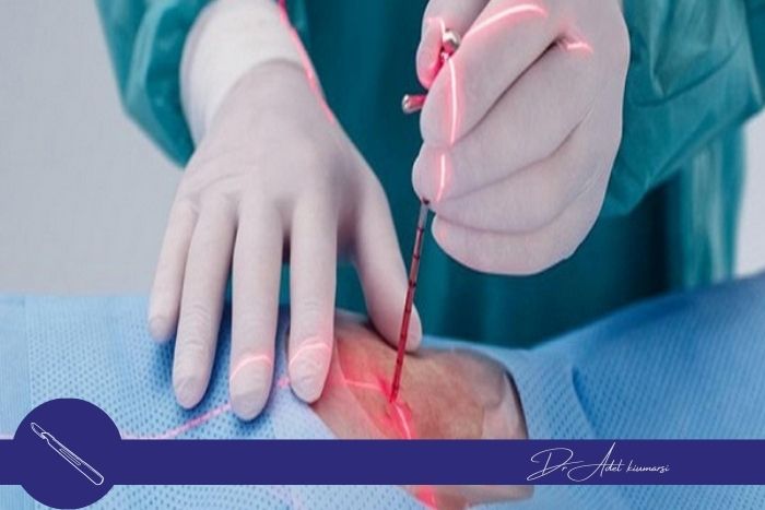 ویژگی‌های جراحی بسته در بیماران چاق