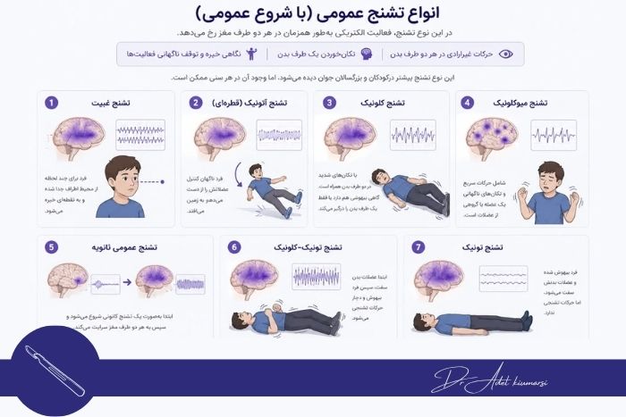 بررسی انواع تشنج بررسی انواع تشنج