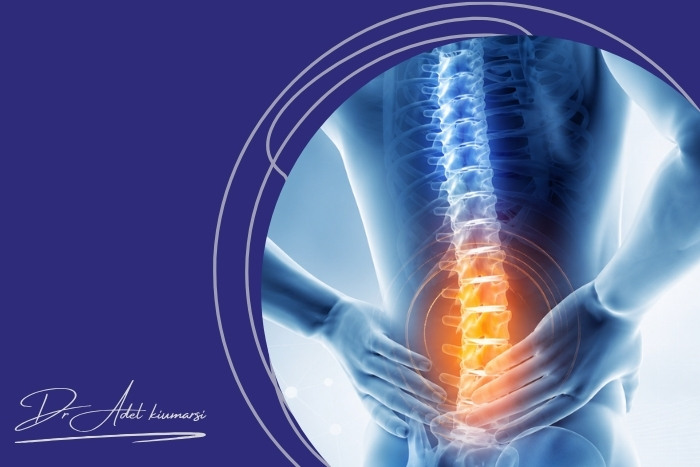 احتمال عود دیسک کمر بعد از جراحی چقدر است؟ احتمال عود دیسک کمر بعد از جراحی چقدر است؟